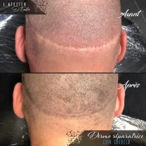 Tricopigmentation cheveux pont-audemer 27500
